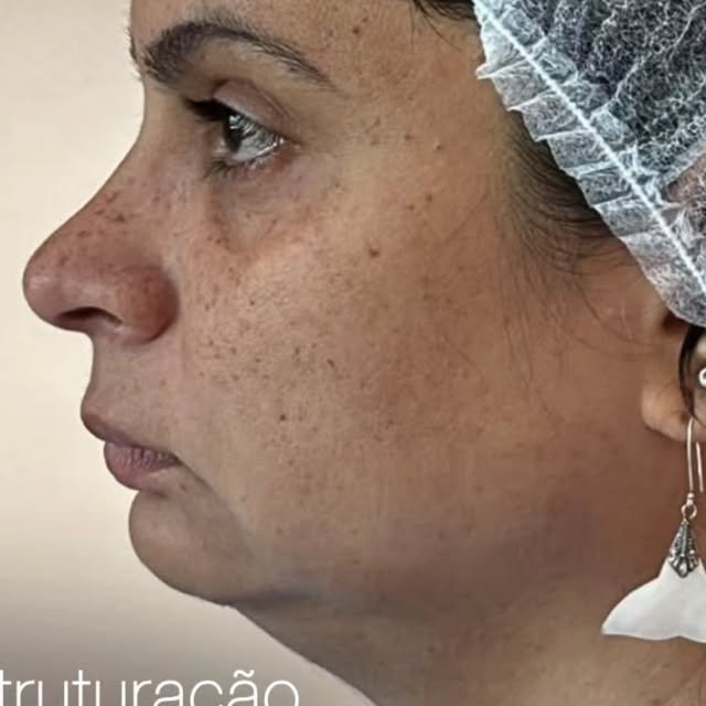Imagem de publicação sobre reestruturação facial