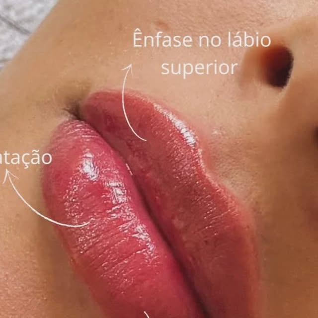 Detalhe de lábios em publicação sobre preenchimento