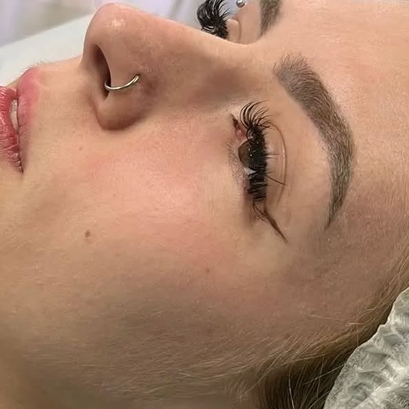 Registro de procedimento de preenchimento labial